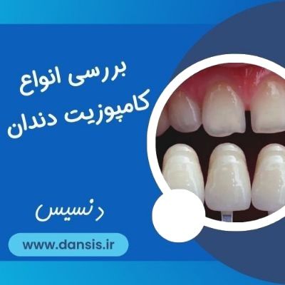 انواع کامپوزیت دندان