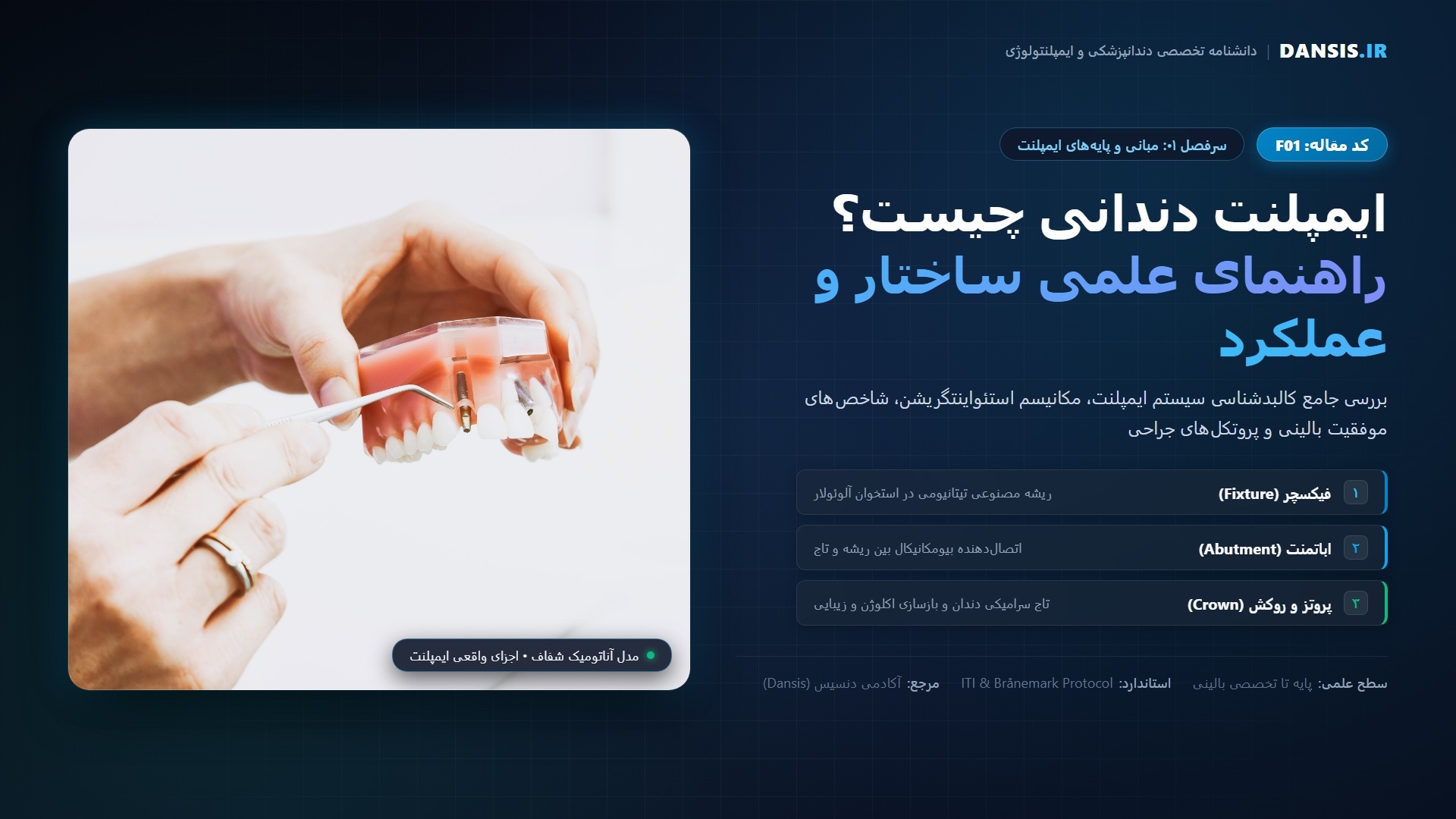 ایمپلنت دندانی چیست؟ راهنمای جامع