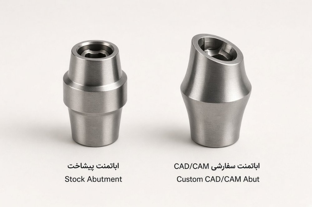 مقایسه اباتمنت پیشساخته Stock و اباتمنت اختصاصی Custom