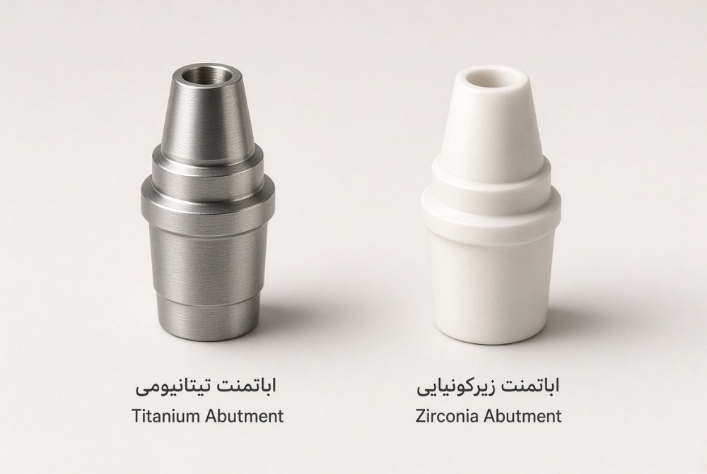 مقایسه ظاهری اباتمنت تیتانیومی و زیرکونیایی ایمپلنت